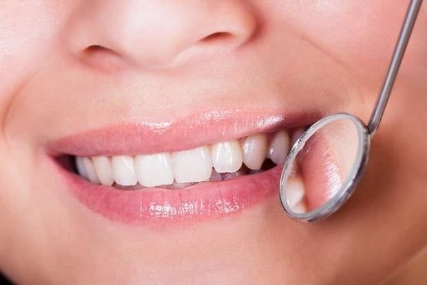 Beyaz dişler neden daha sağlıklı değil?
