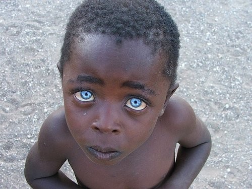Mavi gözlü Afrikalılar evrenin bir mucizesi