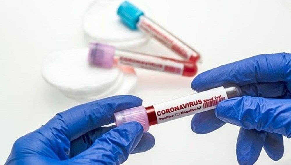 Verem aşısı korona virüs ölümlerini engelleyebilir