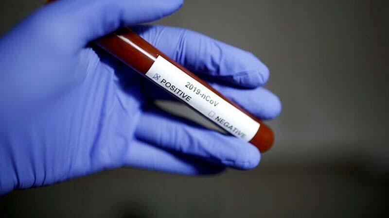 FDA, 2 dakikada sonuç verecek koronavirüs testine onay verdi