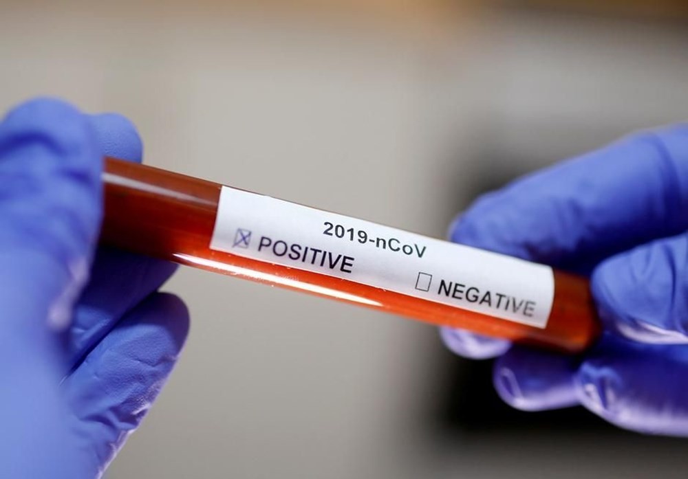 Korona virüse karşı en riskli kan grubu belirlendi