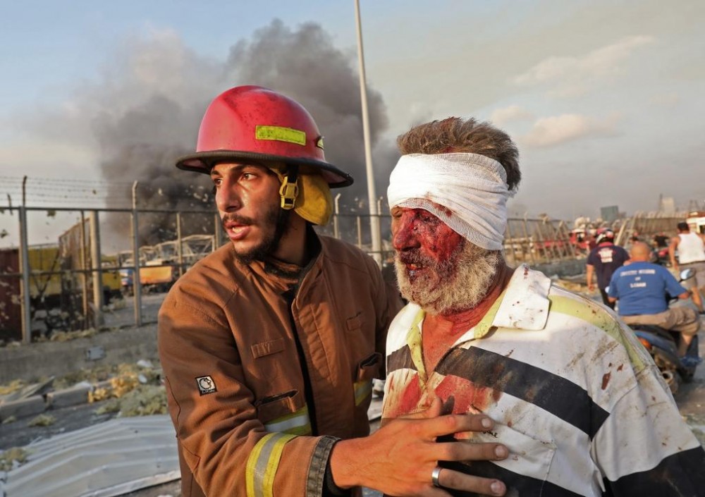 Beyrut'taki patlamanın ardından korkunç görüntüler
