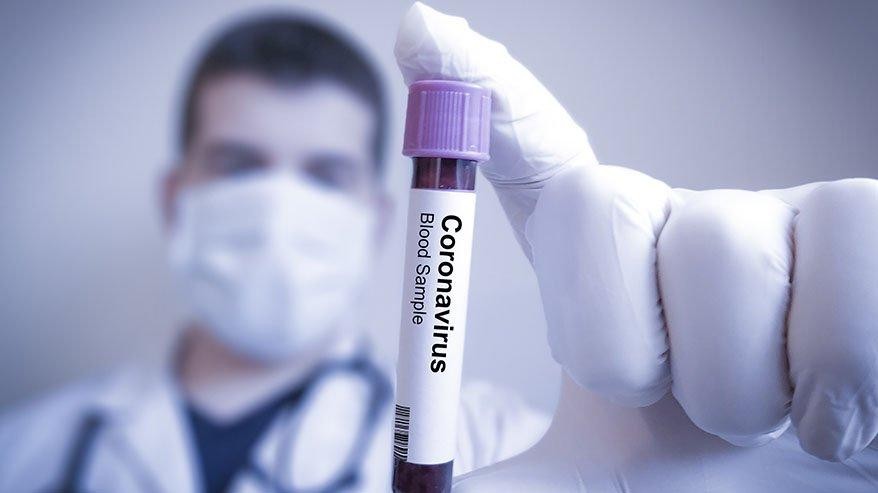 Korona virüs sonrası bu belirtiler kalabiliyor: 15 semptoma dikkat!