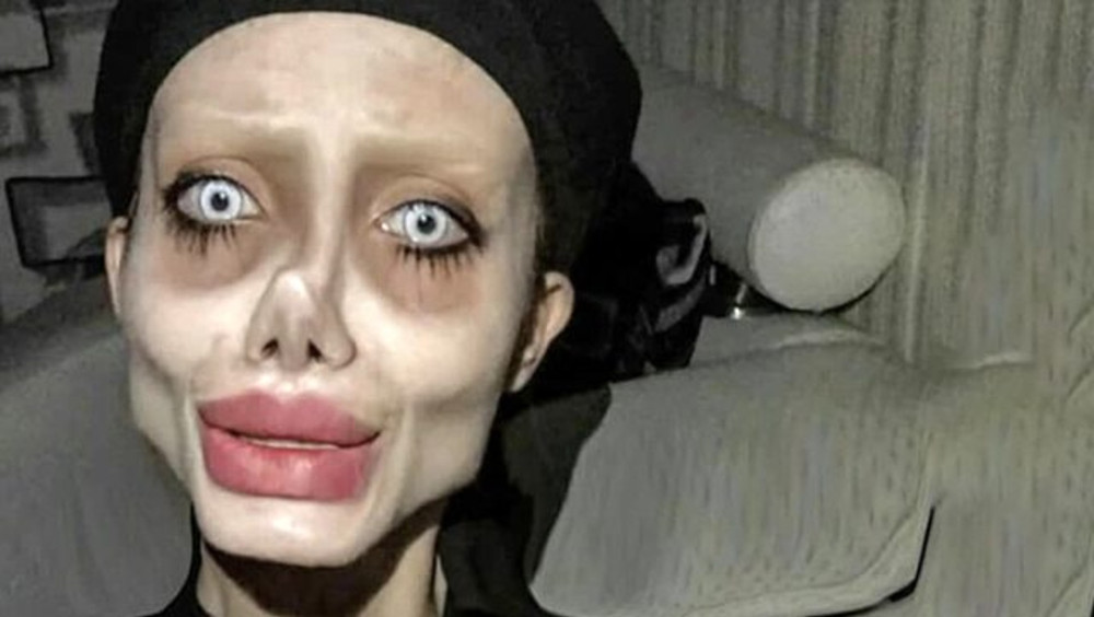 Angelina Jolie’ye benzemek için 50 ameliyat geçirmişti: Son hali olay oldu