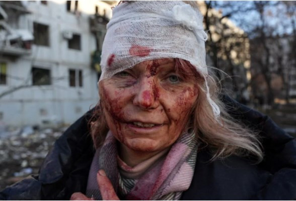 Fotoğraflarla Rusya Ukrayna savaşı