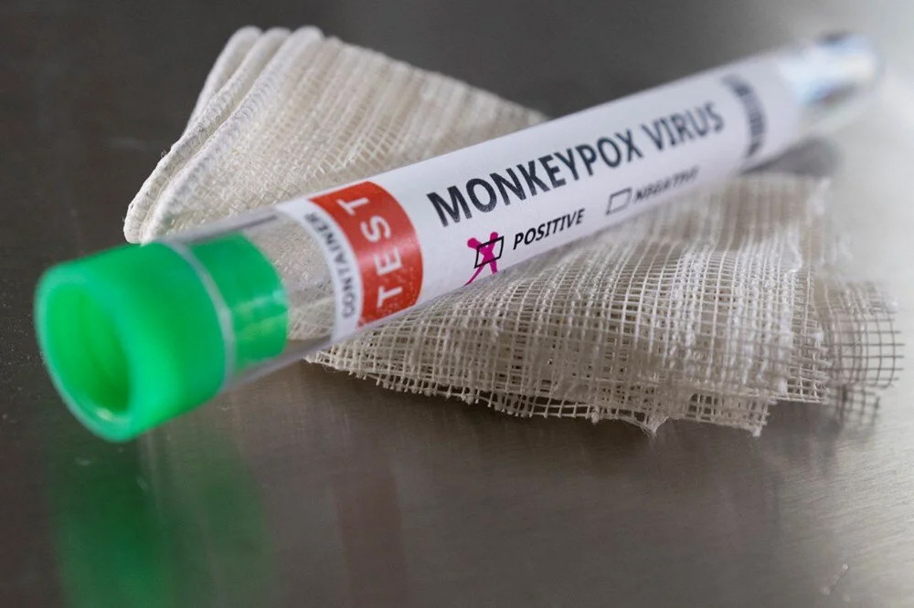 Maymun çiçeğine karşı Almanya'dan binlerce doz aşı siparişi!
