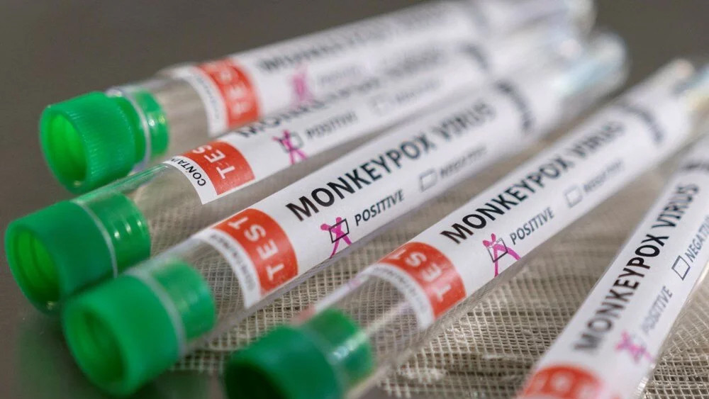 Maymun çiçeğine karşı Almanya'dan binlerce doz aşı siparişi!