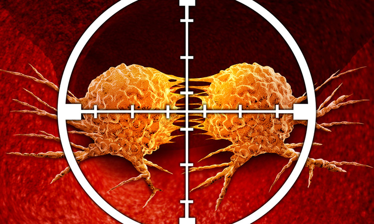 Tıpta çığır açan buluş: Kanser hücrelerini öldüren virüs!