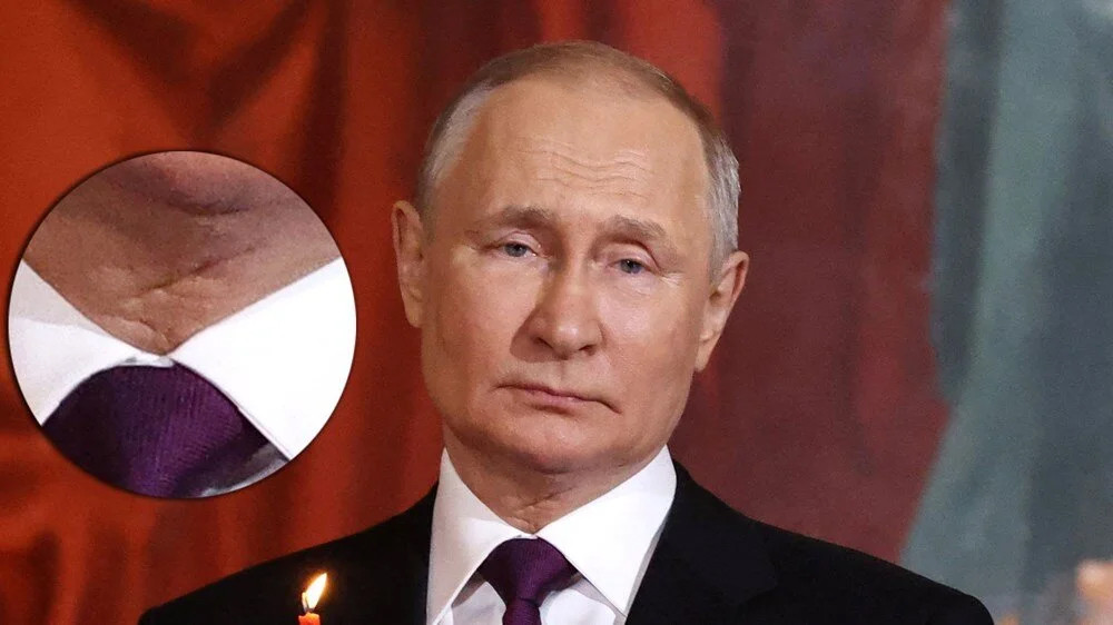 Boynundaki iz dedikoduları tekrar alevlendirdi: Putin kanser mi oldu?
