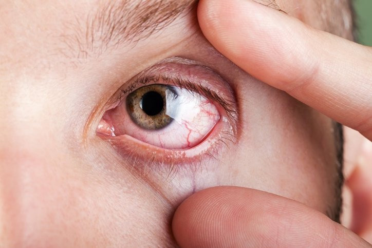 Tip 2 diyabetin gizli işareti: Gözlerinizde ortaya çıkan bu hisse dikkat!