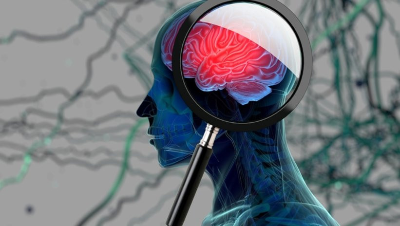 Erken dönem Alzheimer belirtileri: Beynin sessiz çığlığı!
