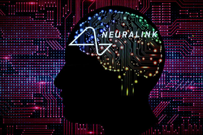 Musk onay aldı: İnsanlar üzerinde beyin çipi deneyleri başlıyor!